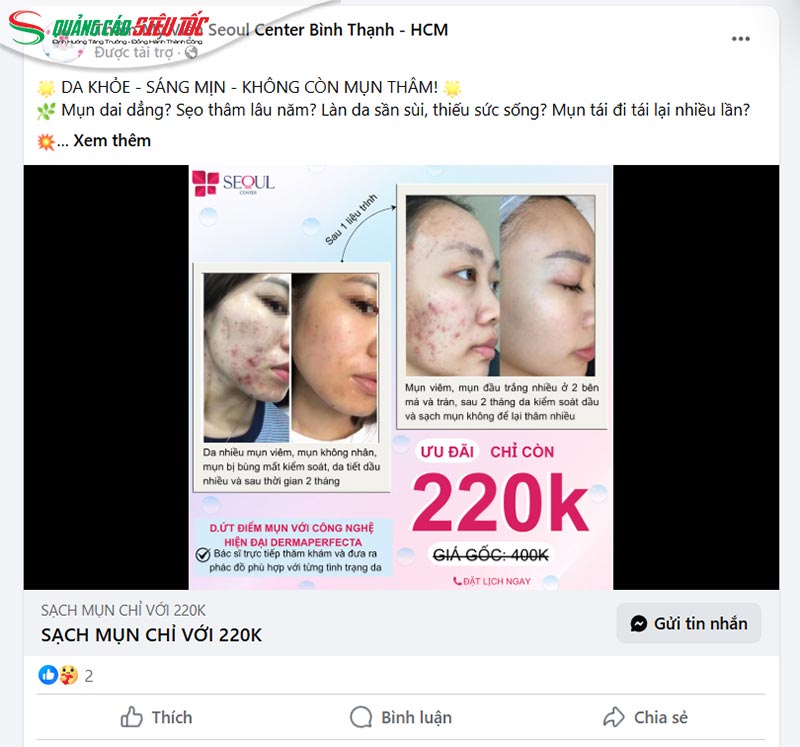 Nội dung so sánh trước - sau Nội dung so sánh trước - sau